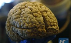 A resident takes a look at a human brain specimen at the Brain Health Fair held at Vancouver Convention Centre in Vancouver, Canada, April, 15, 2016. 