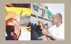 Right to left: Dr Sam Christian at protest and after he was hit by a stone at Soufriere
