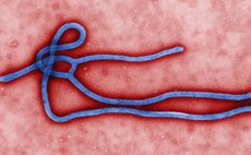 Ebola virus