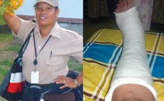 Lucia Esprit and photo of damaged foot
