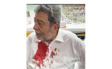 Injured St Vincent Prime Minister Ralph Gonsalves