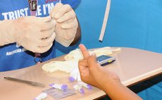 Measuring blood sugar levels